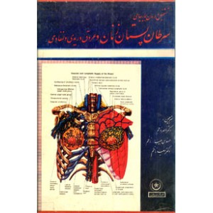 تشخیص و درمان سرطان پستان زنان و بیماریهای عروقی و وریدی و لنفاوى