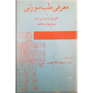 معرفی طب سوزنی با تاثیر مثبت درمانی روی بیماریهای مختلف